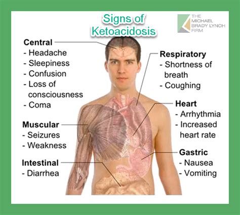 The Warning Signs of Ketoacidosis: A Guide to Avoiding Serious Health Complications